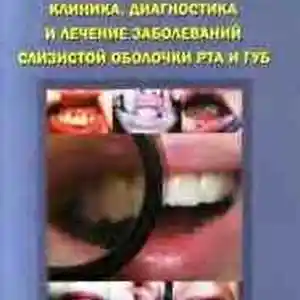 Книга - Клиника, диагностика и лечение заболеваний слизистой оболочки рта и губ
