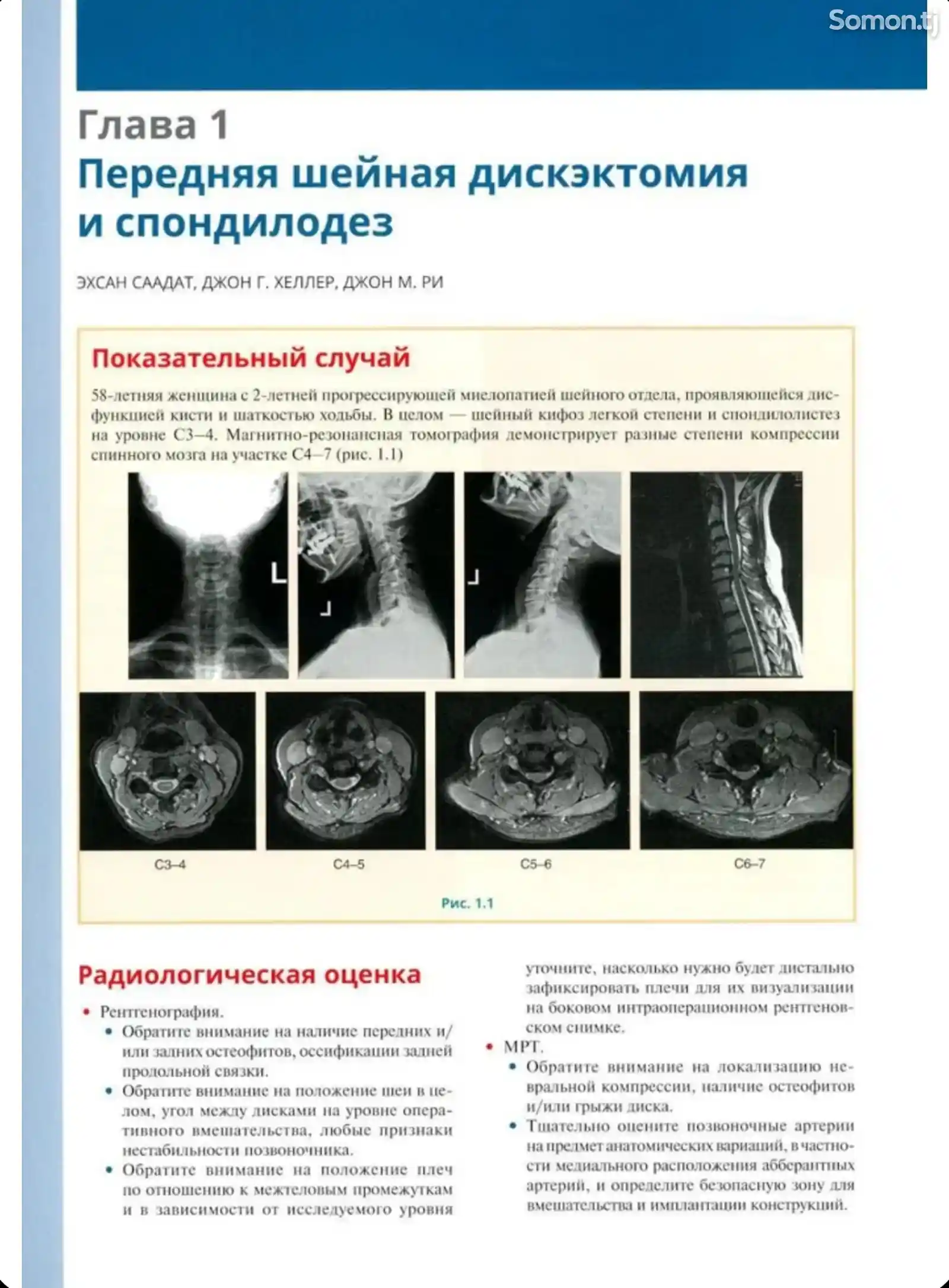 Книга Хирургия позвоночника на заказ-5