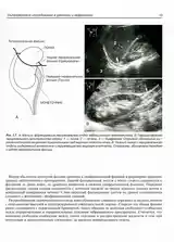 Ультразвуковое исследование в урологии и неврологии-7
