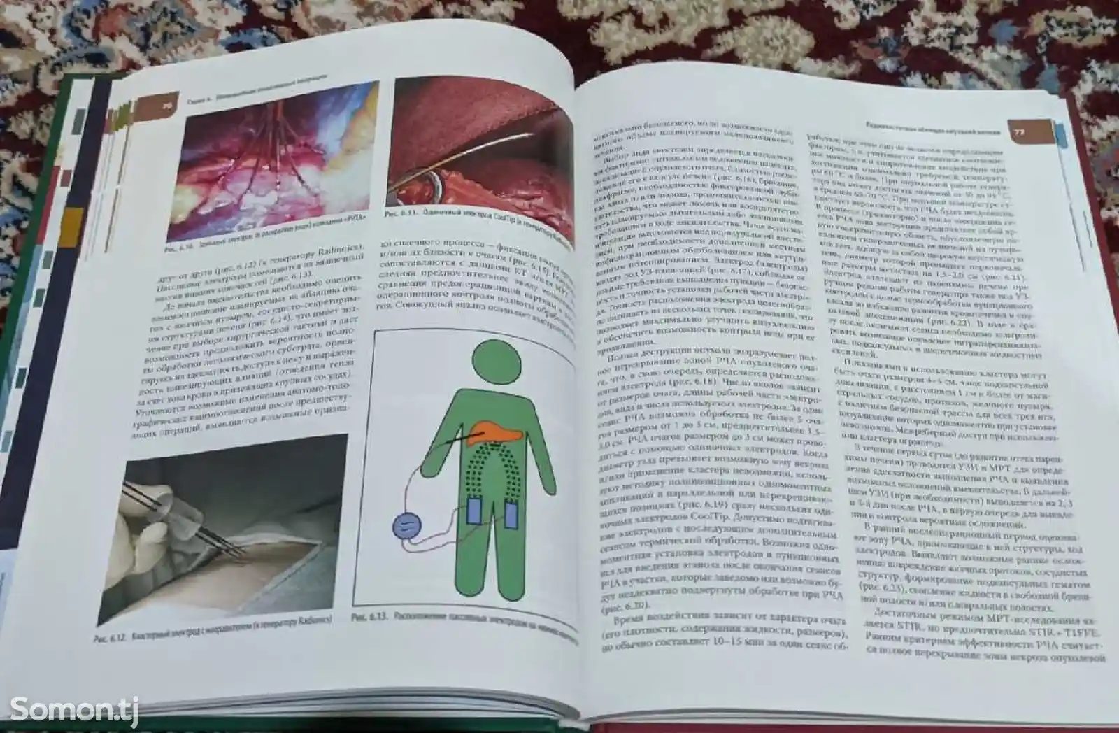 Книга атлас операций печени и поджелудочной железы-6