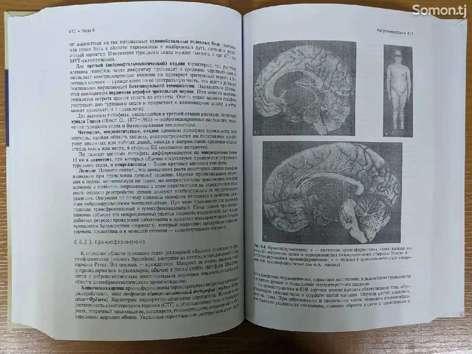 Книга частная неврология-10