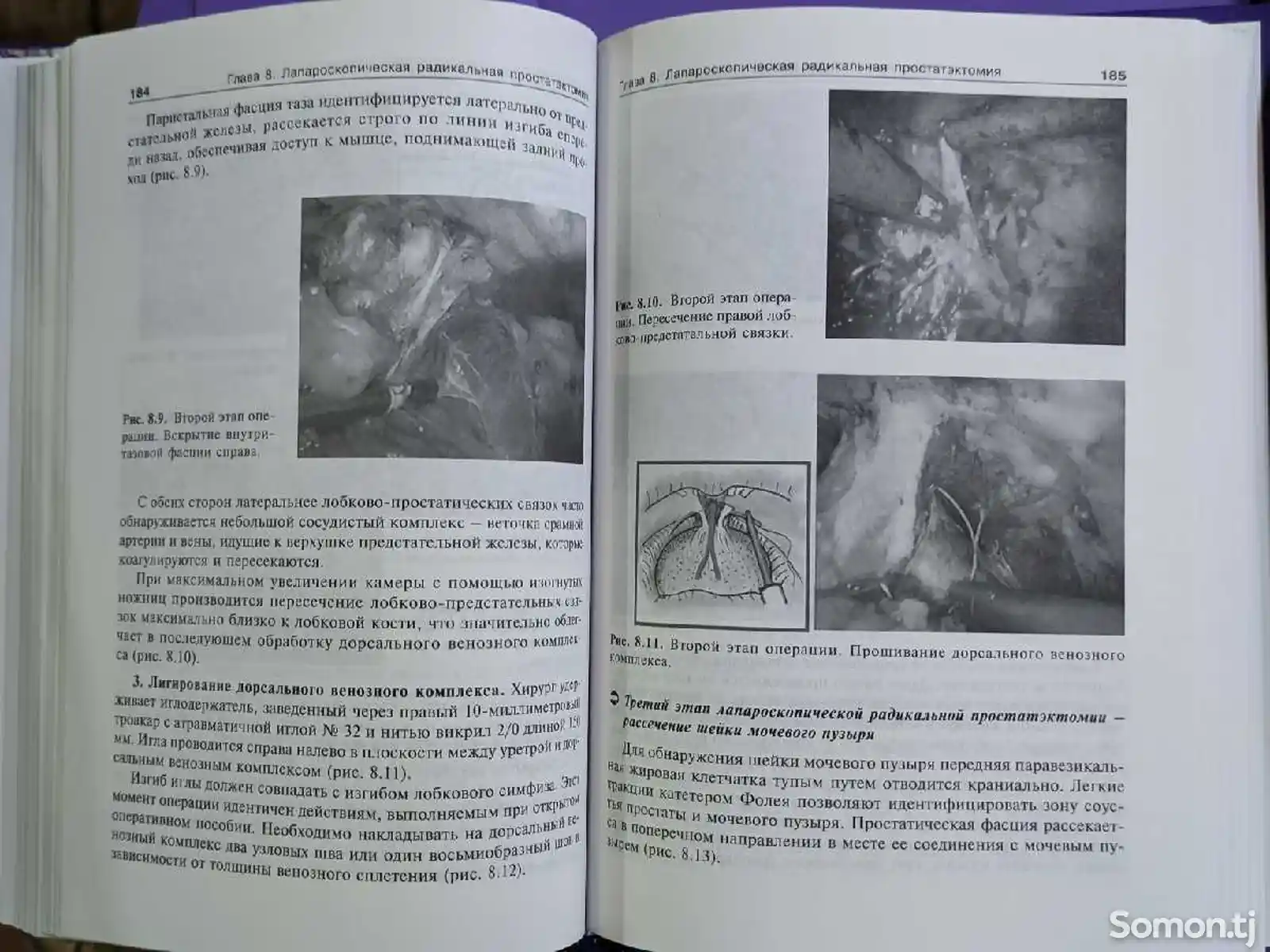 Книга Радикальная хирургия-5