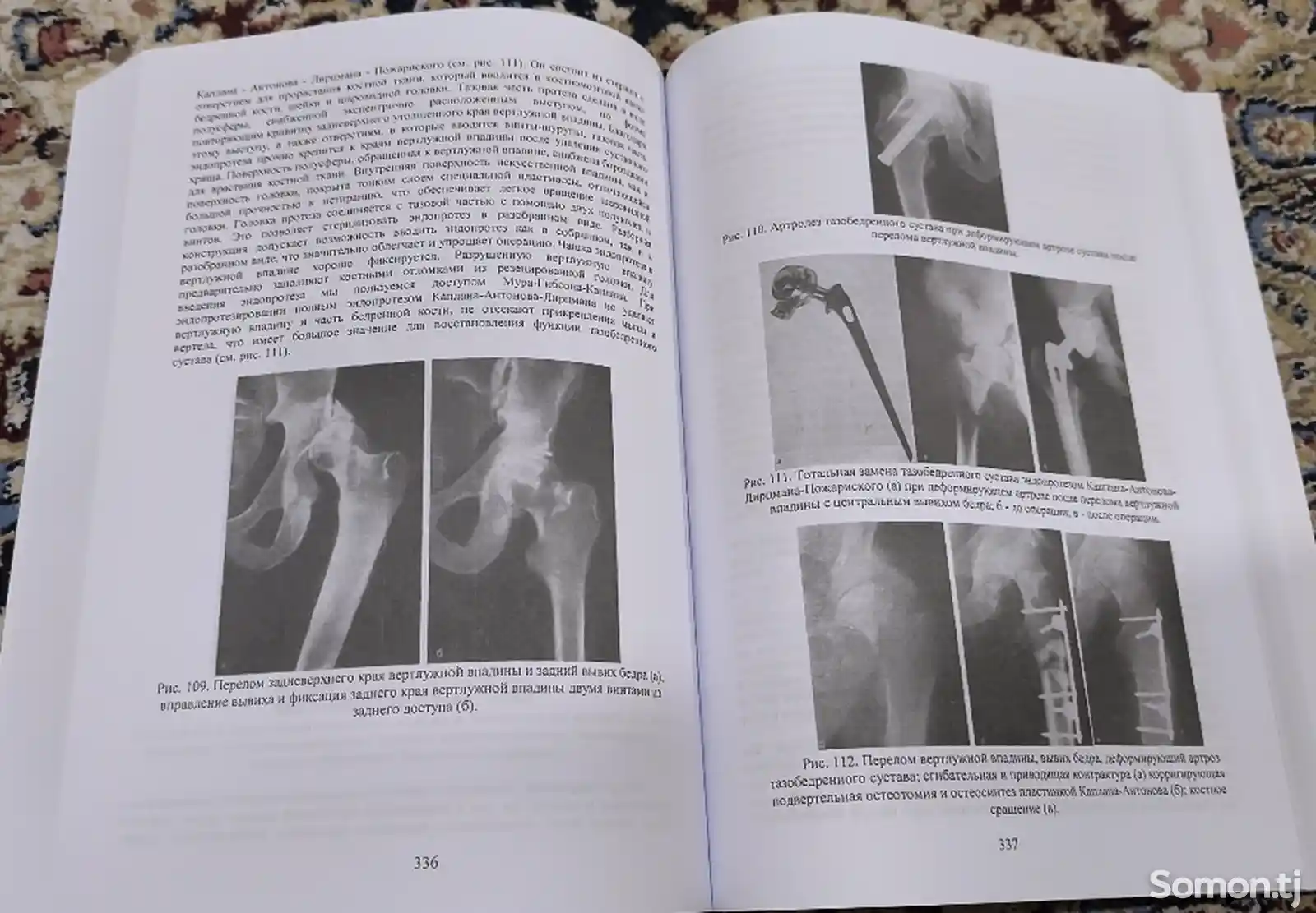 Книга повреждения костей и суставов-12