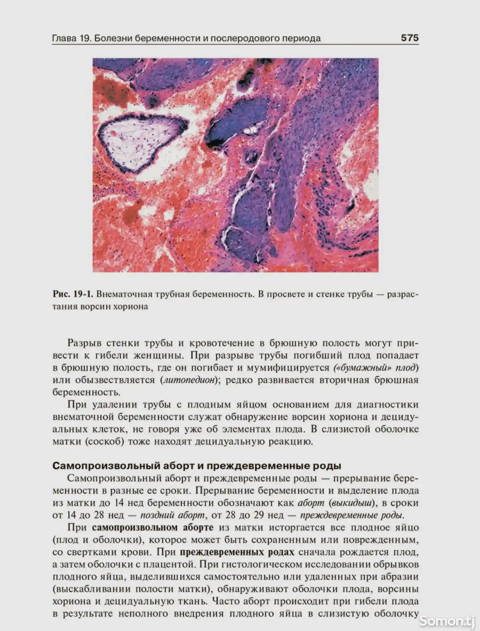 Книга Патологическая анатомия-14