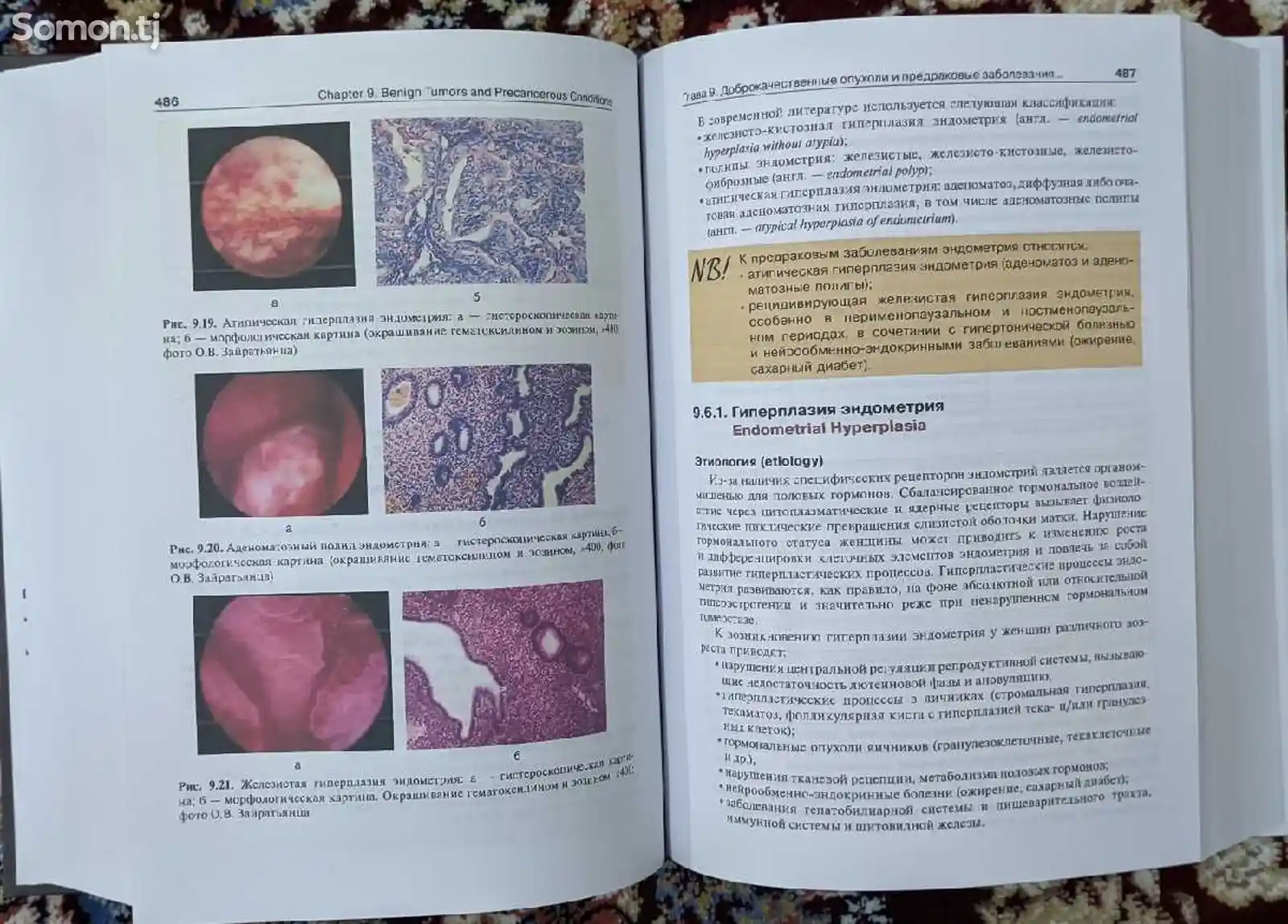Книга Гинекология-9