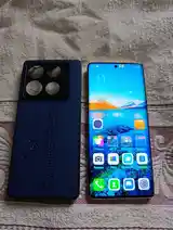 Infinix Note 40 Pro 256/16gb-3