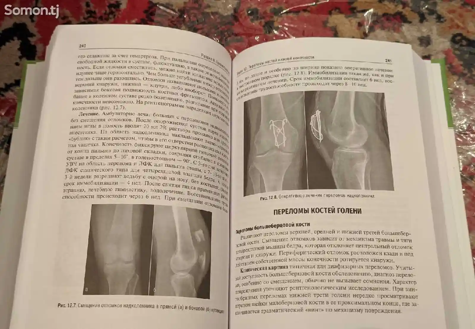 Книга Травматология и ортопедия-7