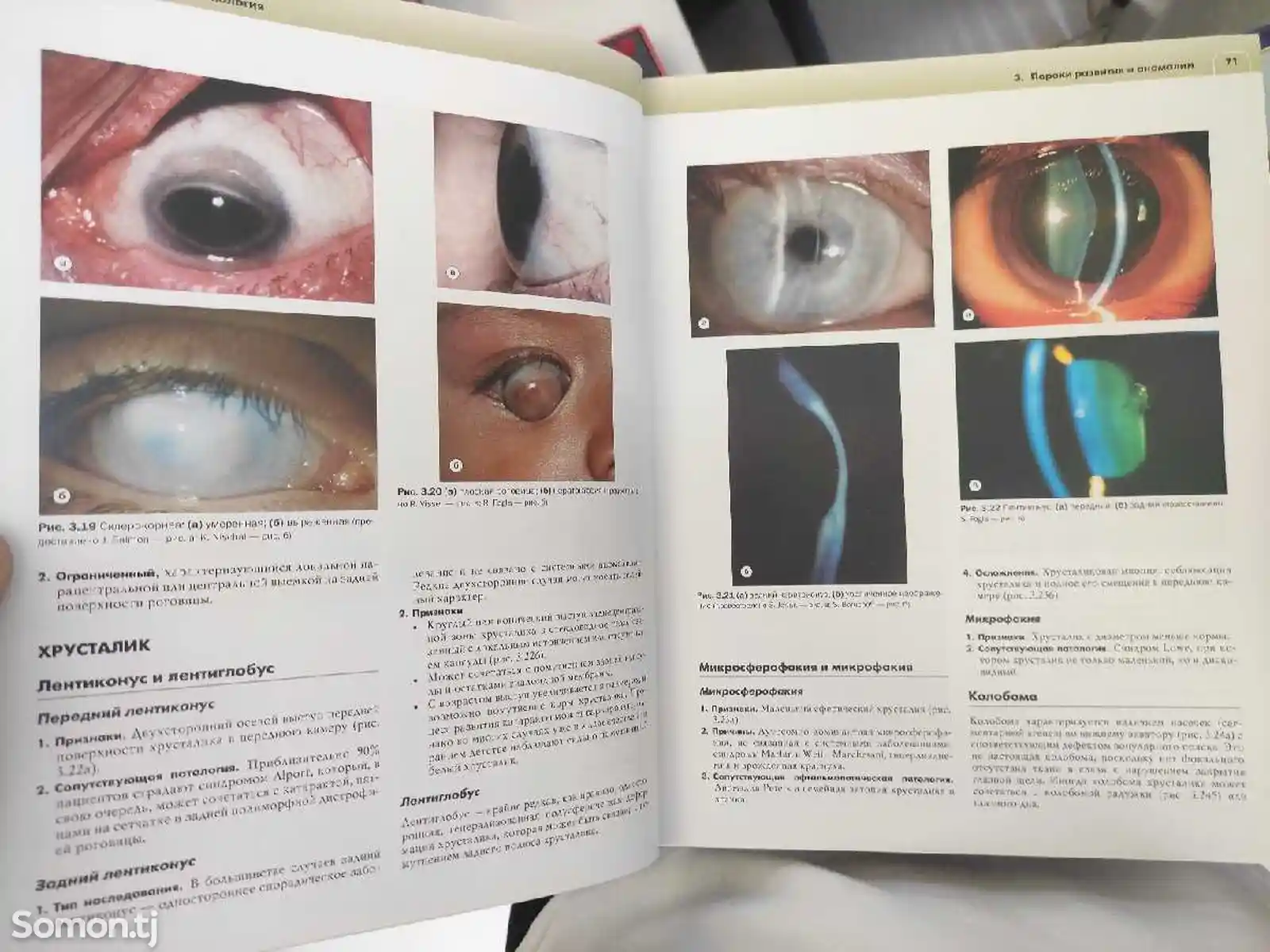 Книга Клиническая офтальмология Кански-6