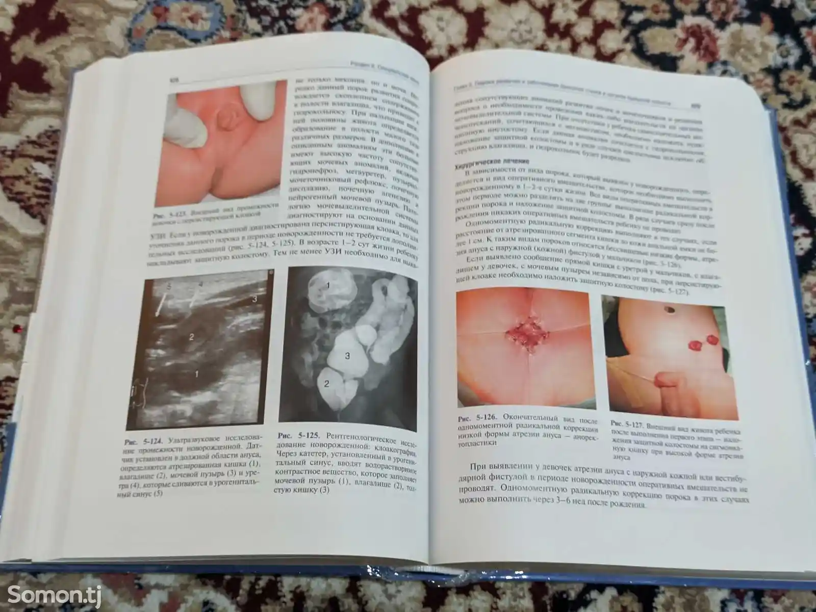 Книга Детская хирургия-12