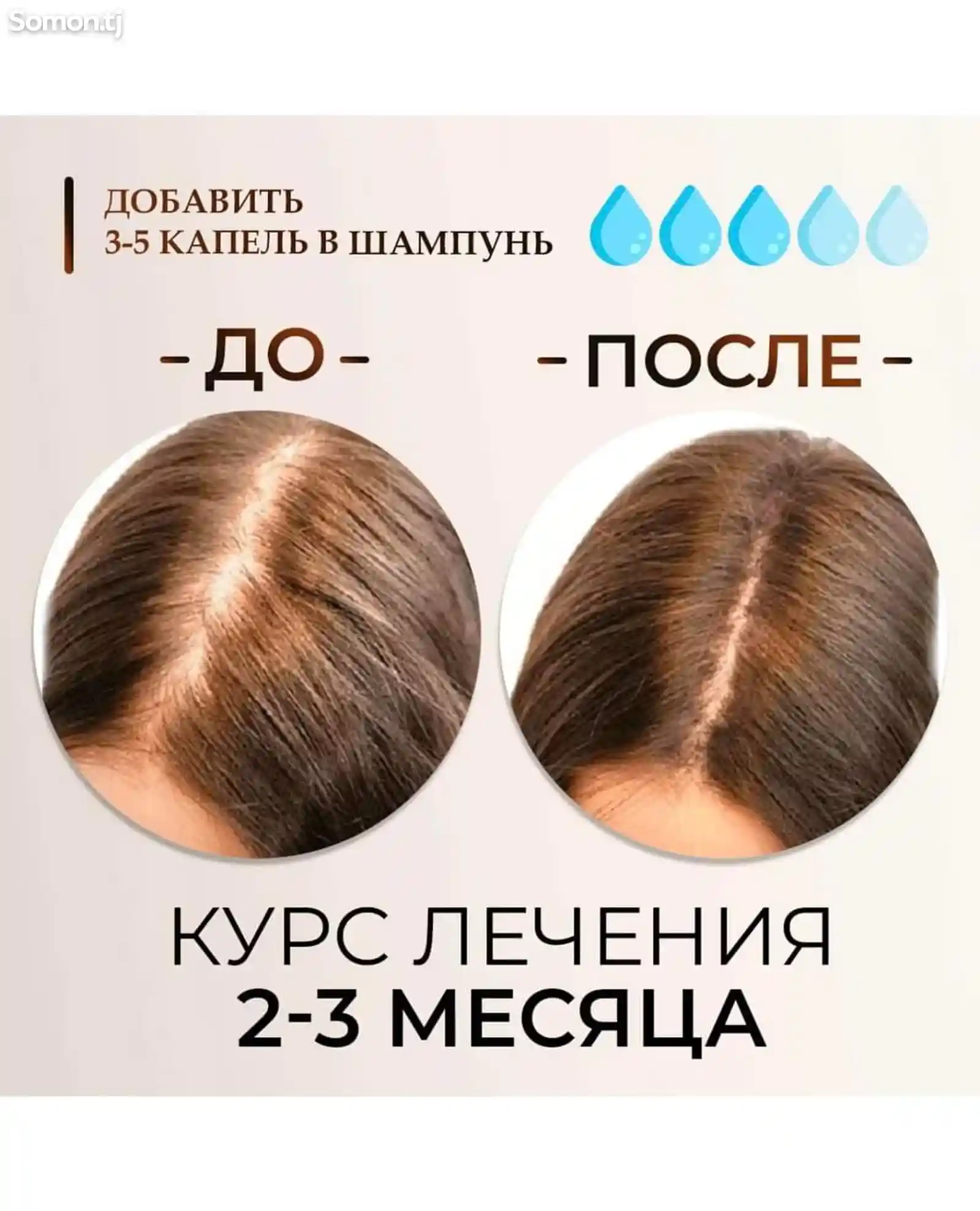 Сыворотка от выпадения и для роста волос с массажной щеткой-2