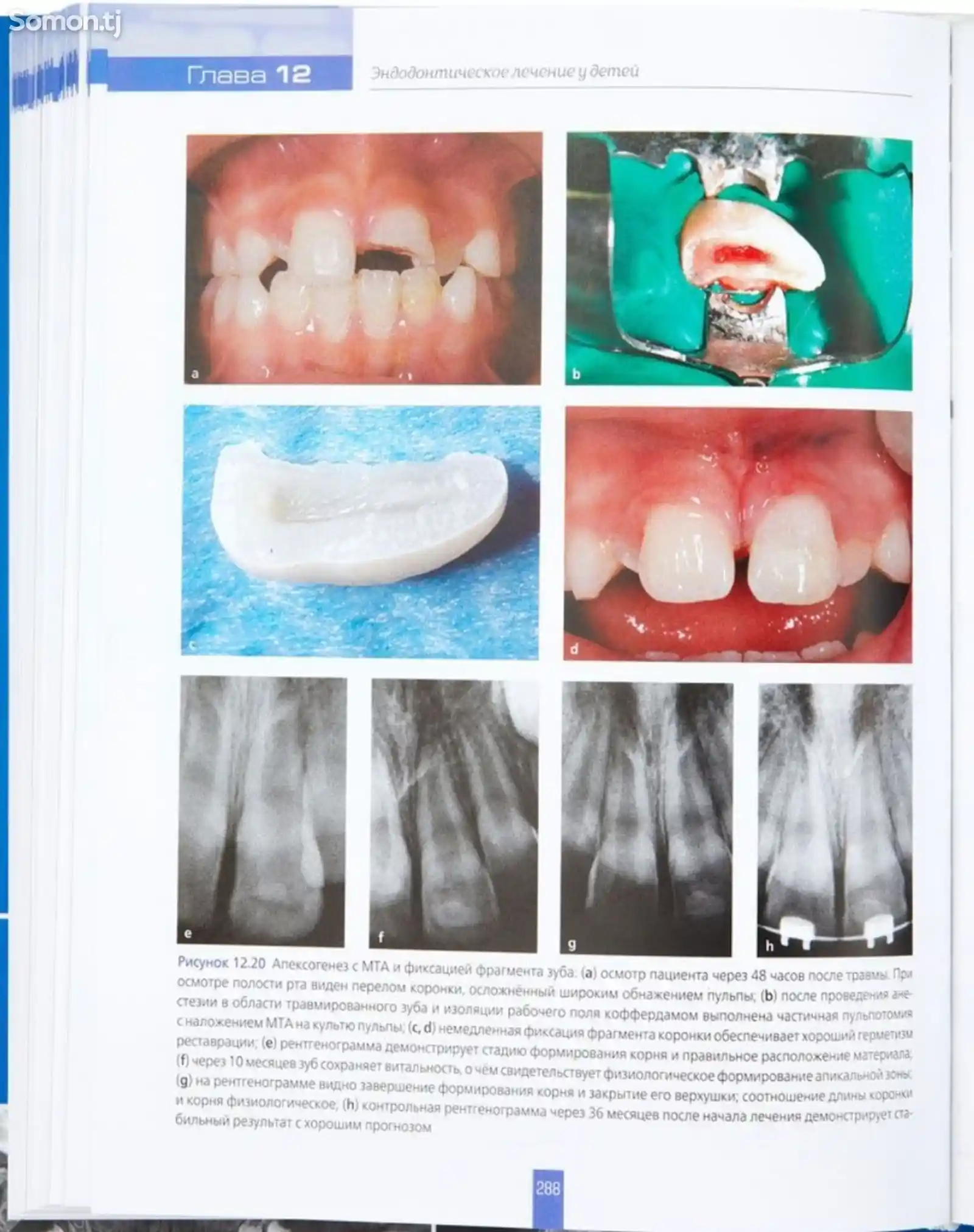 Книга Детская стоматология-8