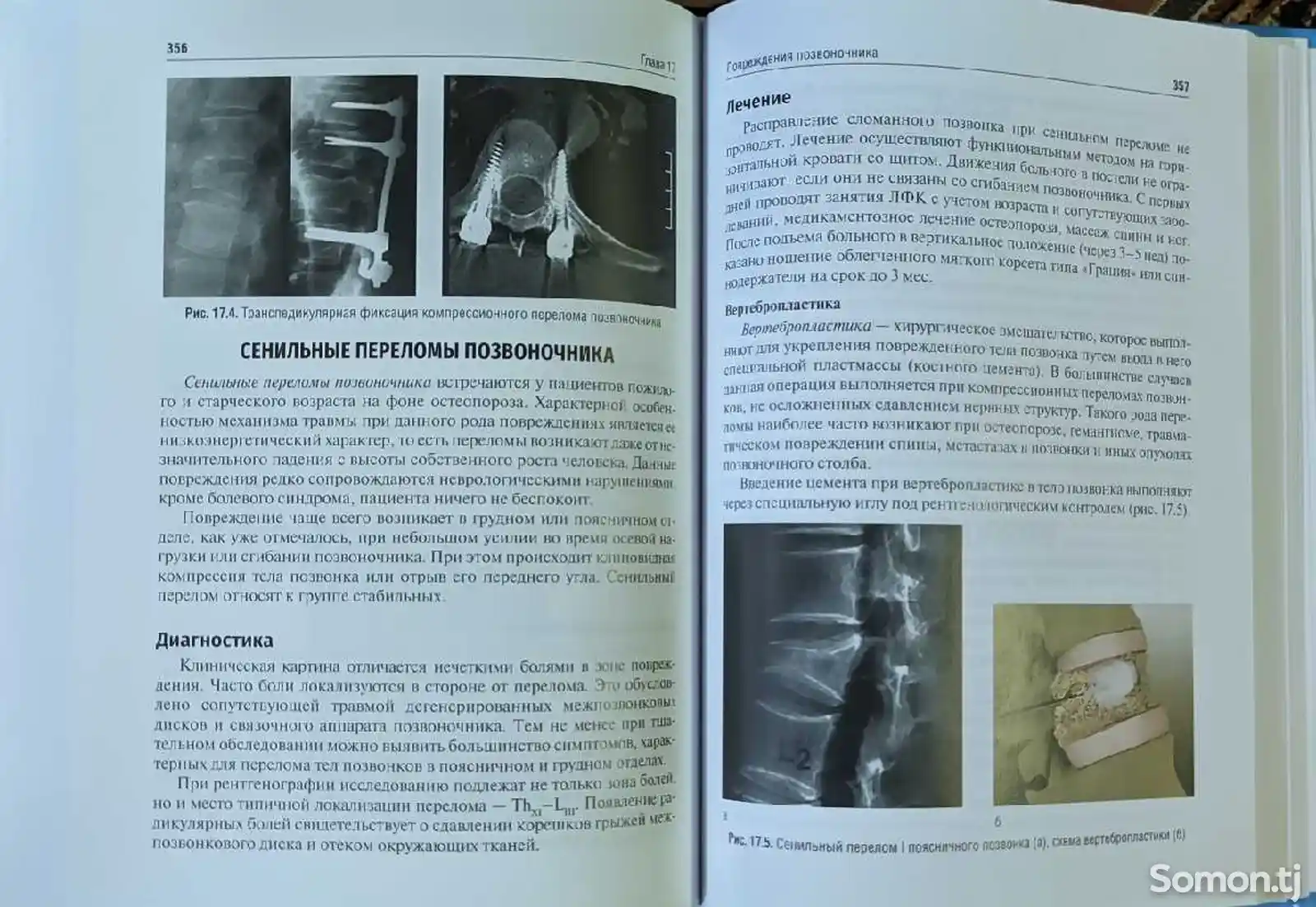 Книга-травматология и ортопедия-10