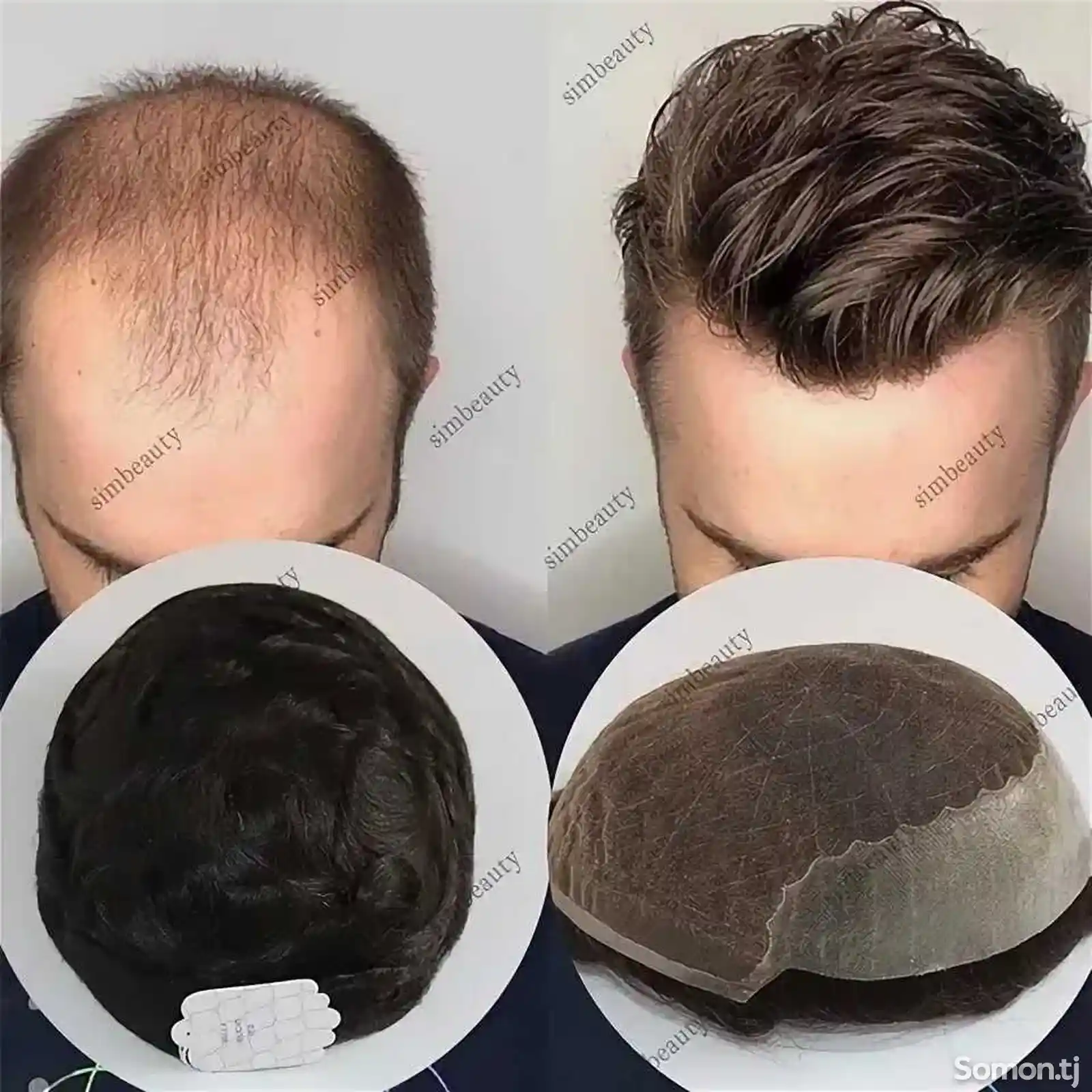 Системный волос для мужчин натуральный-3