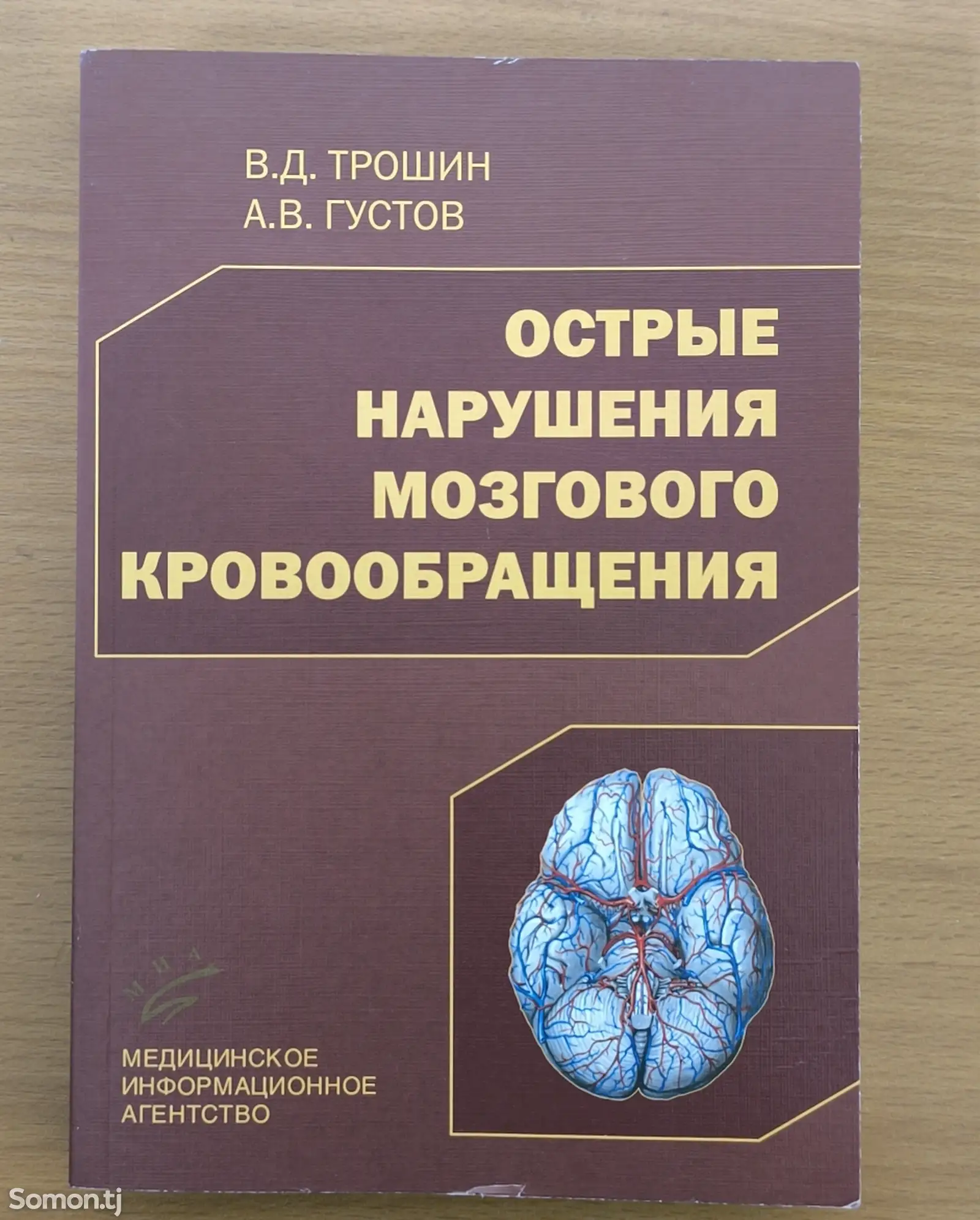 Книга Острые нарушения мозгового кровообращения-1