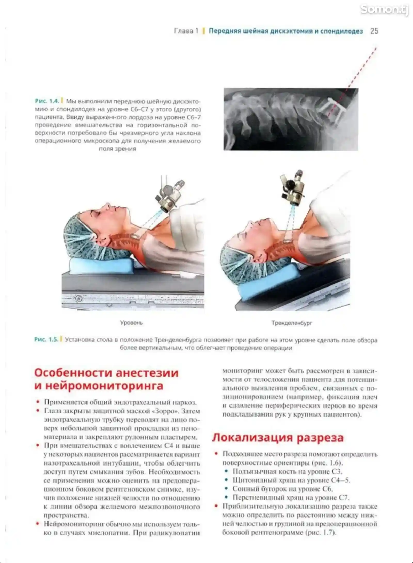 Книга Хирургия позвоночника на заказ-7