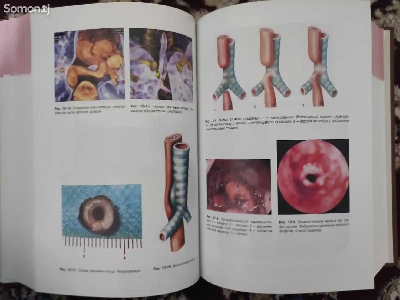 Книга детская хирургия-10