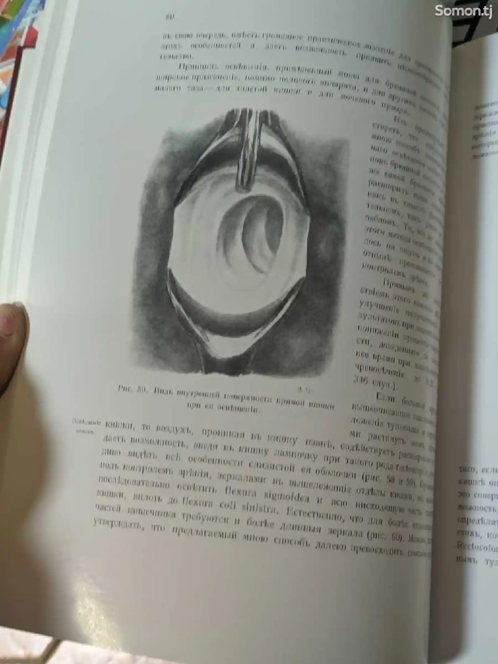 Книга Оперативная гинекология-6