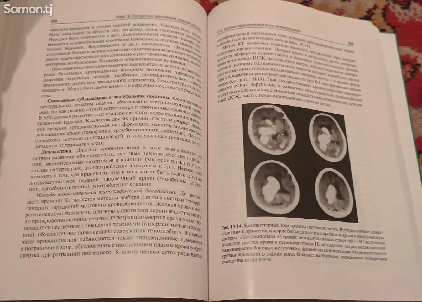 Книга Неврология и Нейрохирургия , 2 Том-6