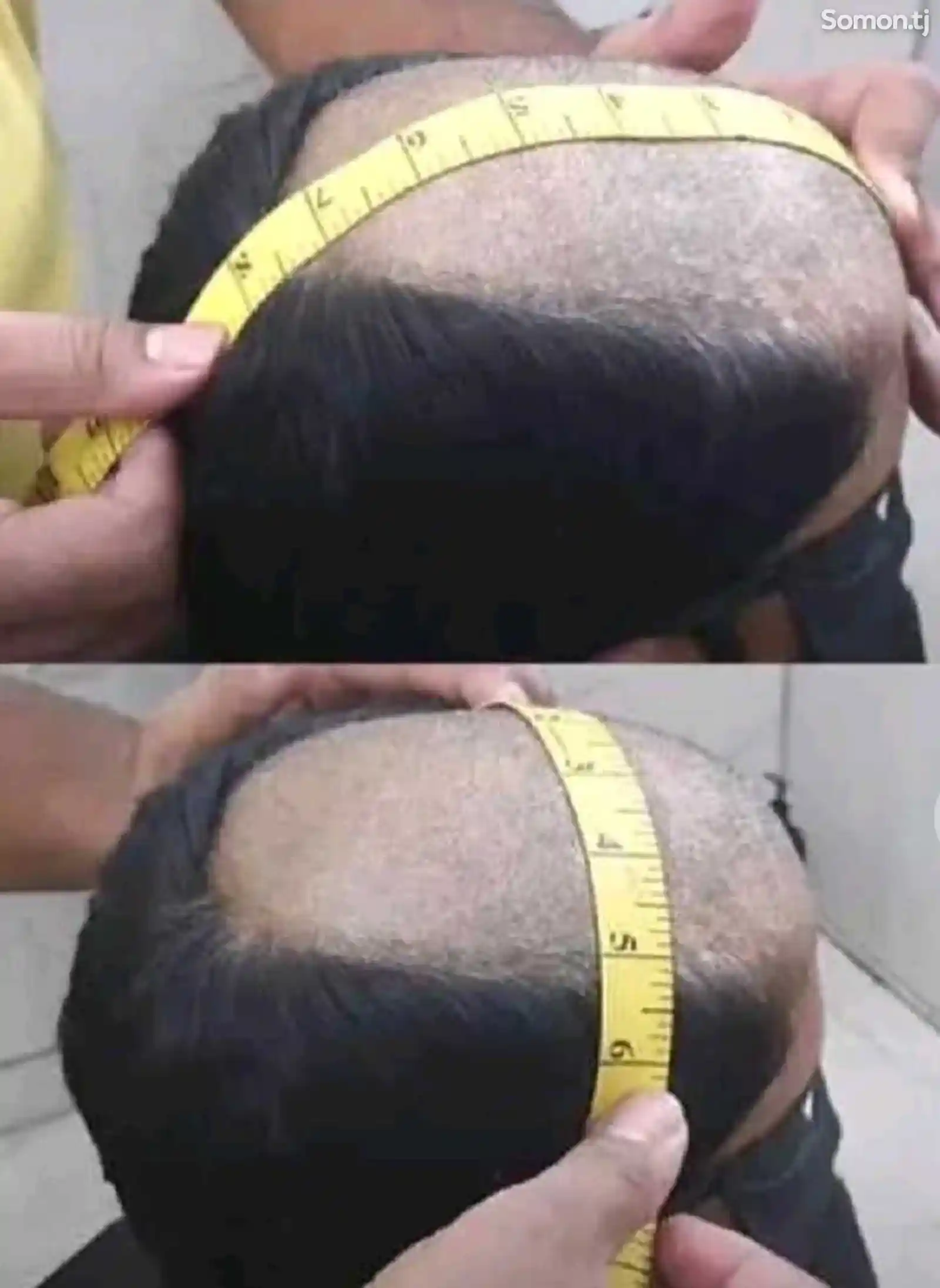 Услуга по наращиванию волос для мужчин-16