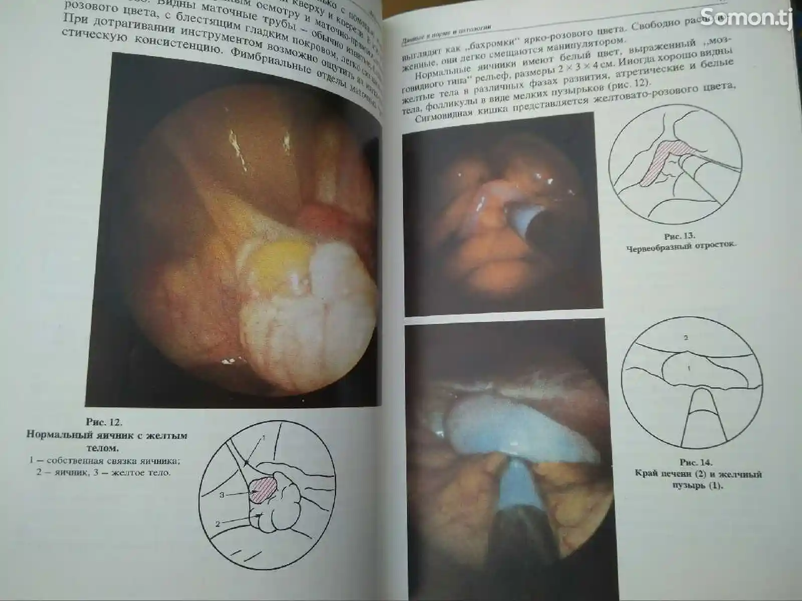 Книга - Эндоскопия в гинекологии-3