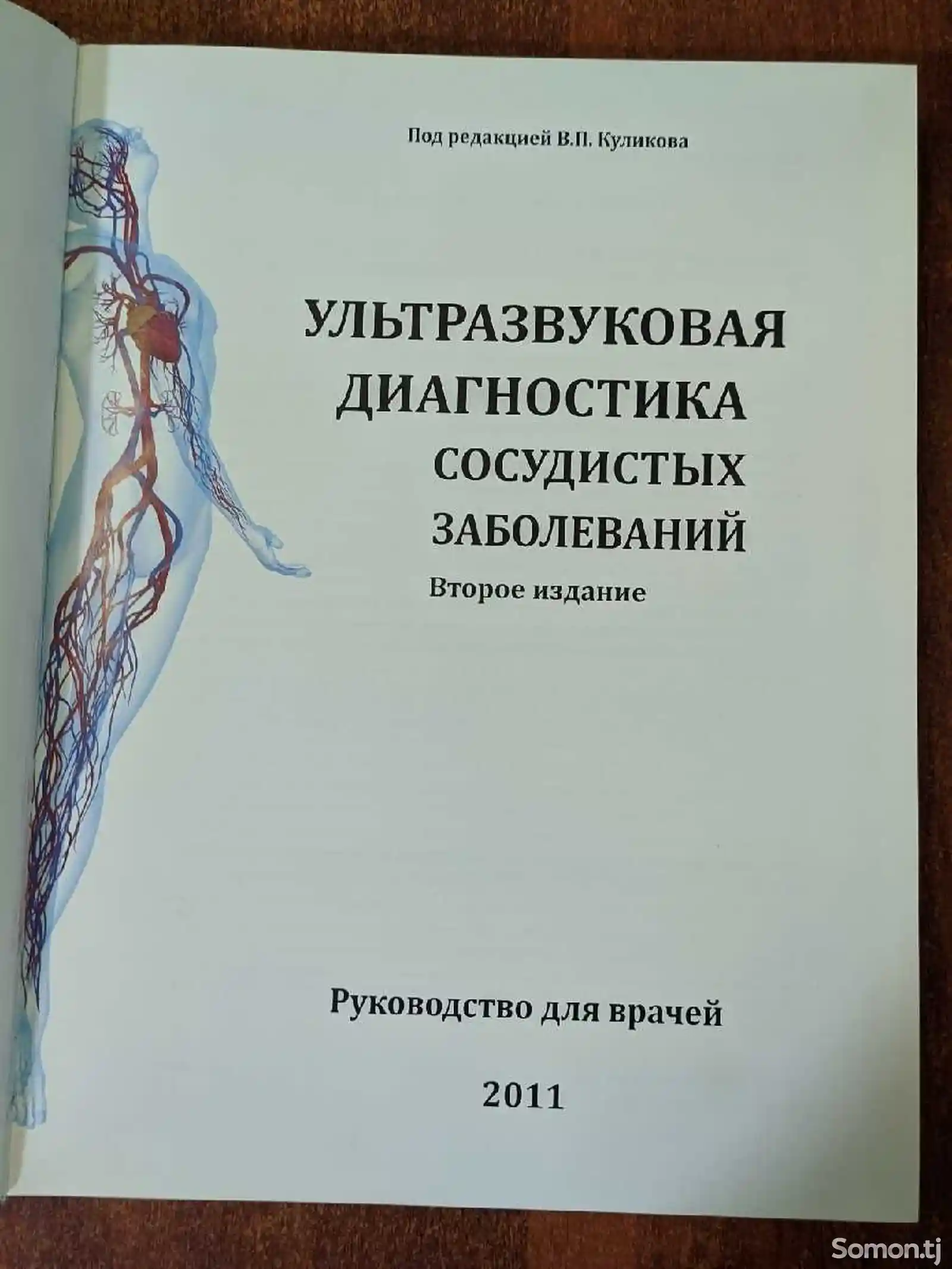 Книга Ультразвуковая диагностика сосудистых заболеваний-2