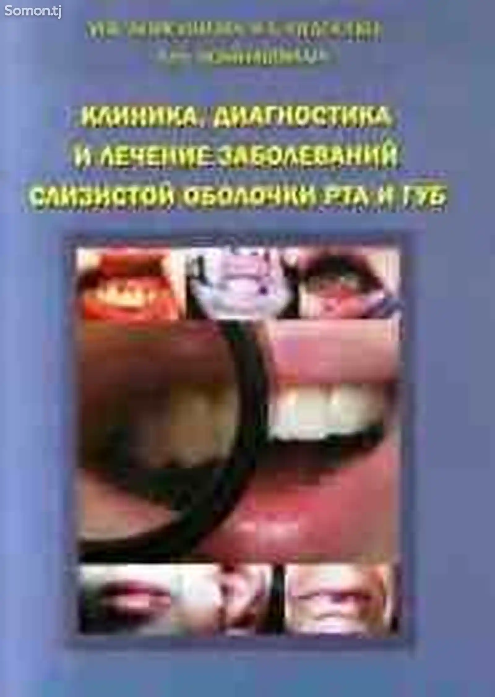 Книга - Клиника, диагностика и лечение заболеваний слизистой оболочки рта и губ-1