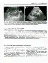 Ультразвуковое исследование в урологии и неврологии-10