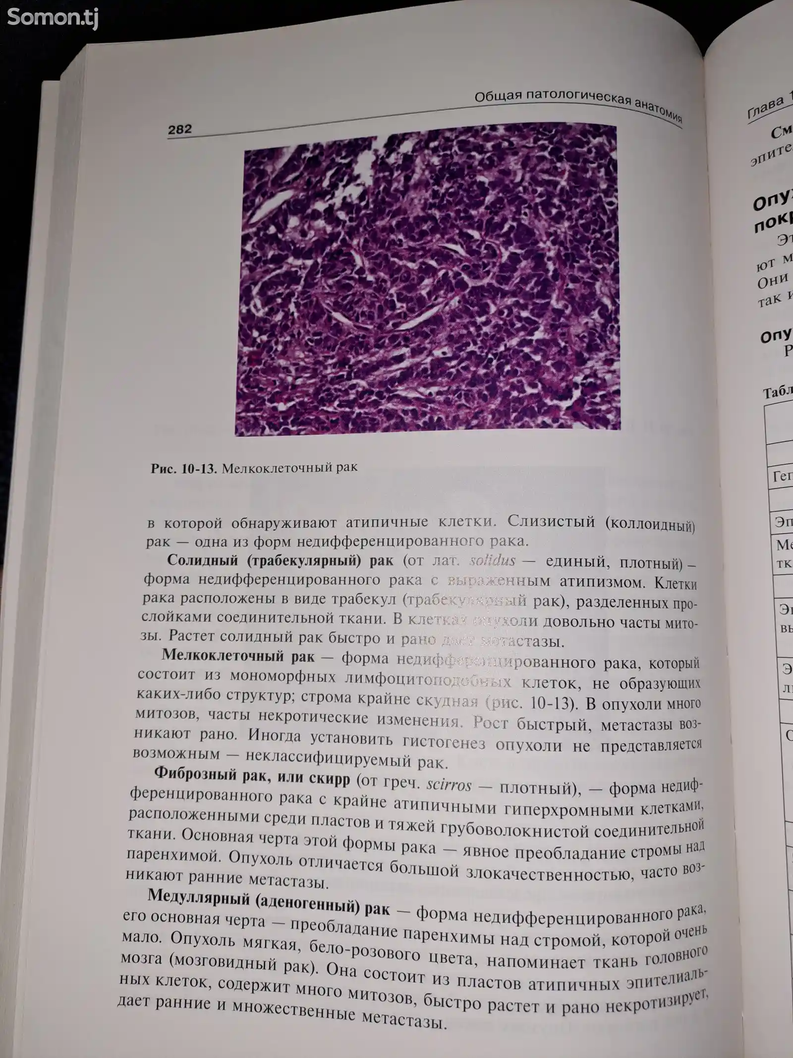 Книга патологическая анатомия А.И. Струков. В.В. Серов-3