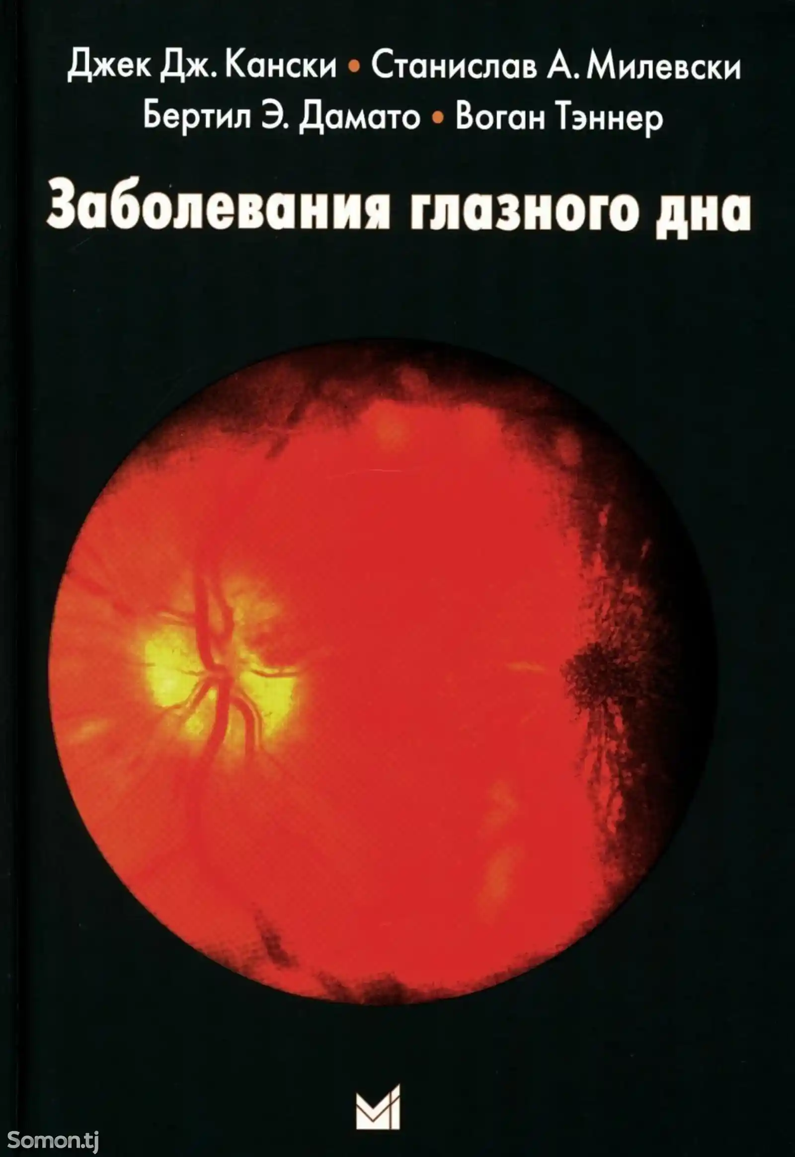 Книга Заболевания глазного дна-1