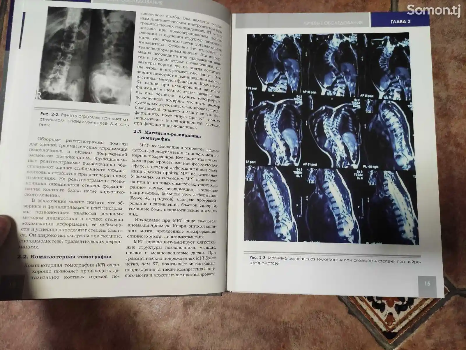 Книга - Хирургия деформаций позвоночника-3