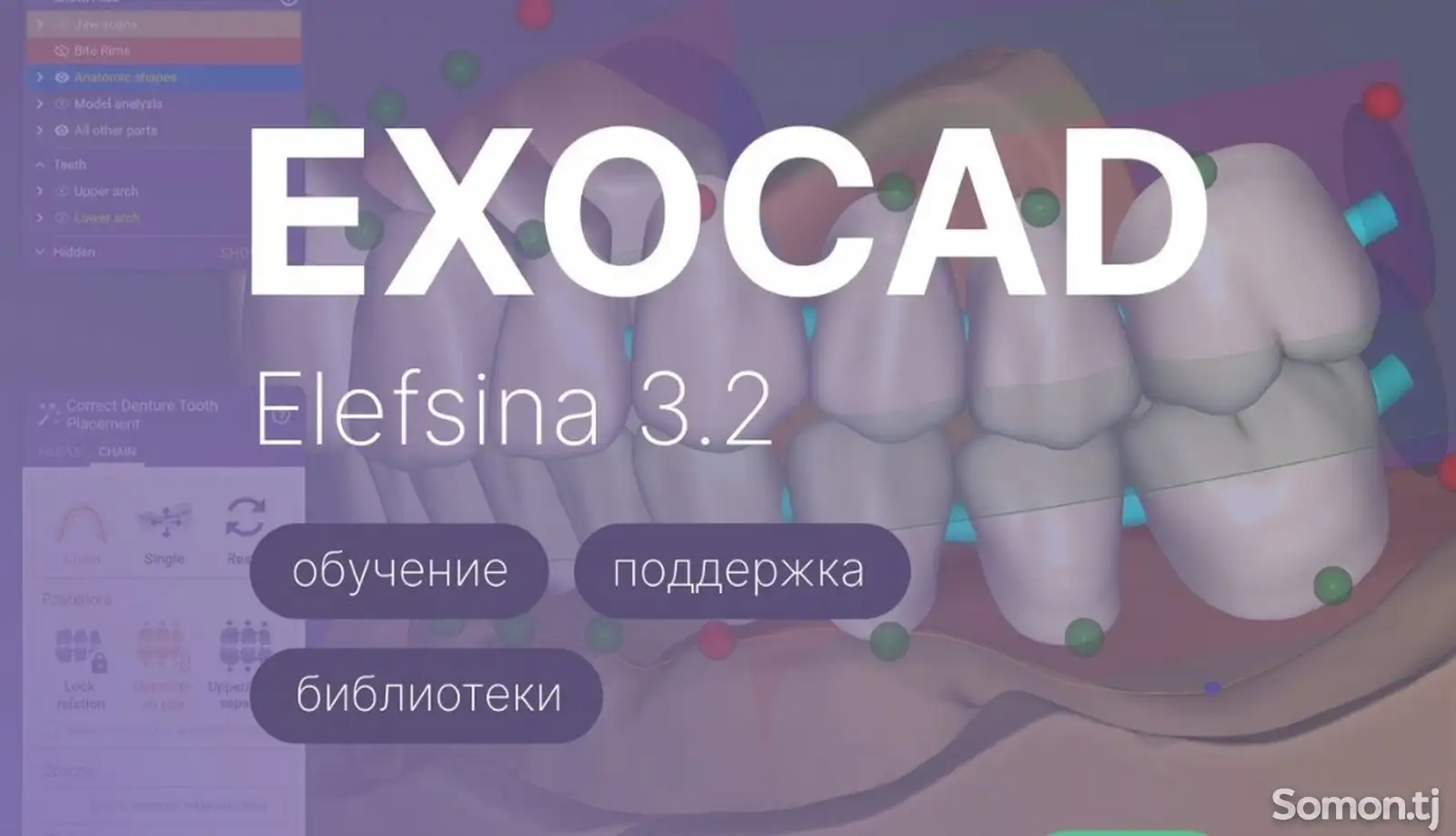 Установка Exocad Elefsina 3.2-1