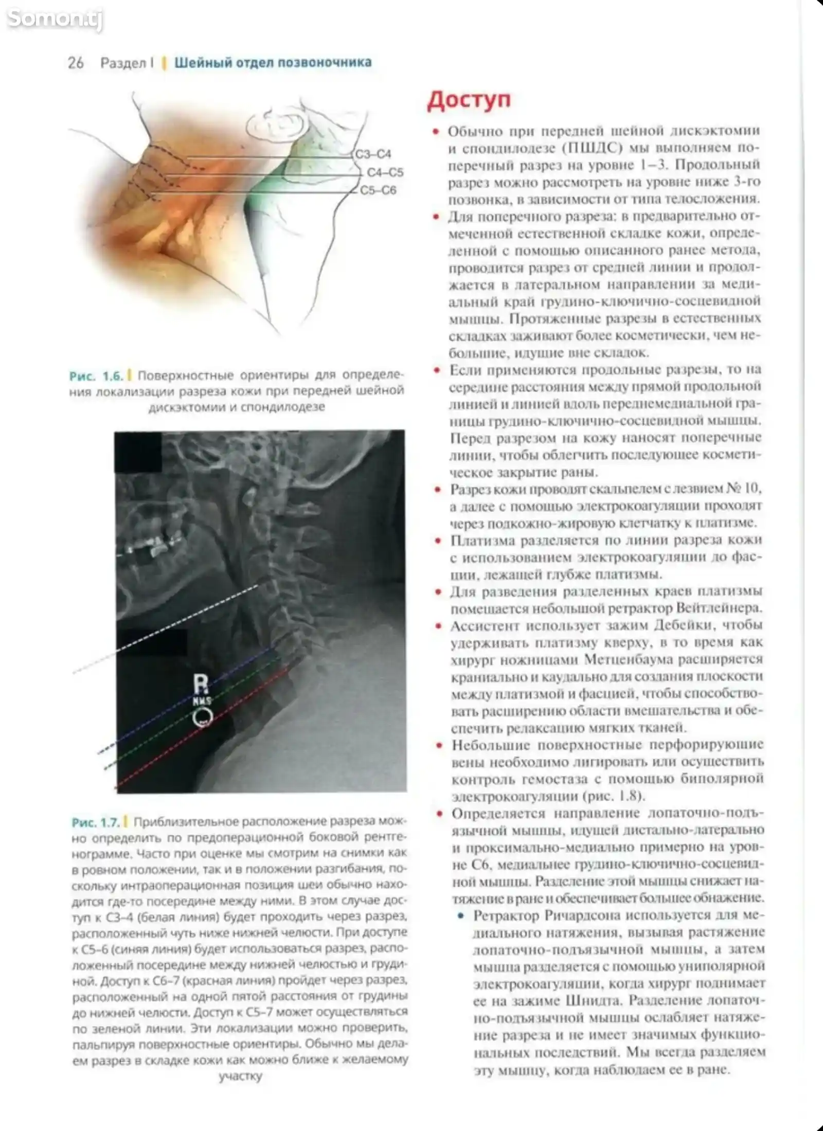 Книга Хирургия позвоночника на заказ-8