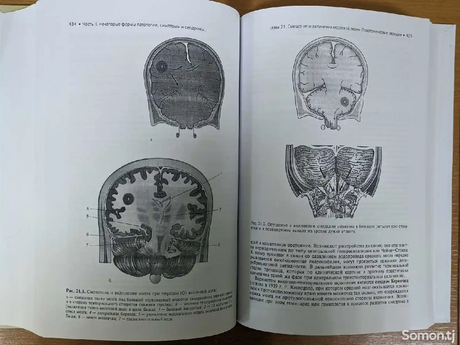 Книга Общая неврология-9