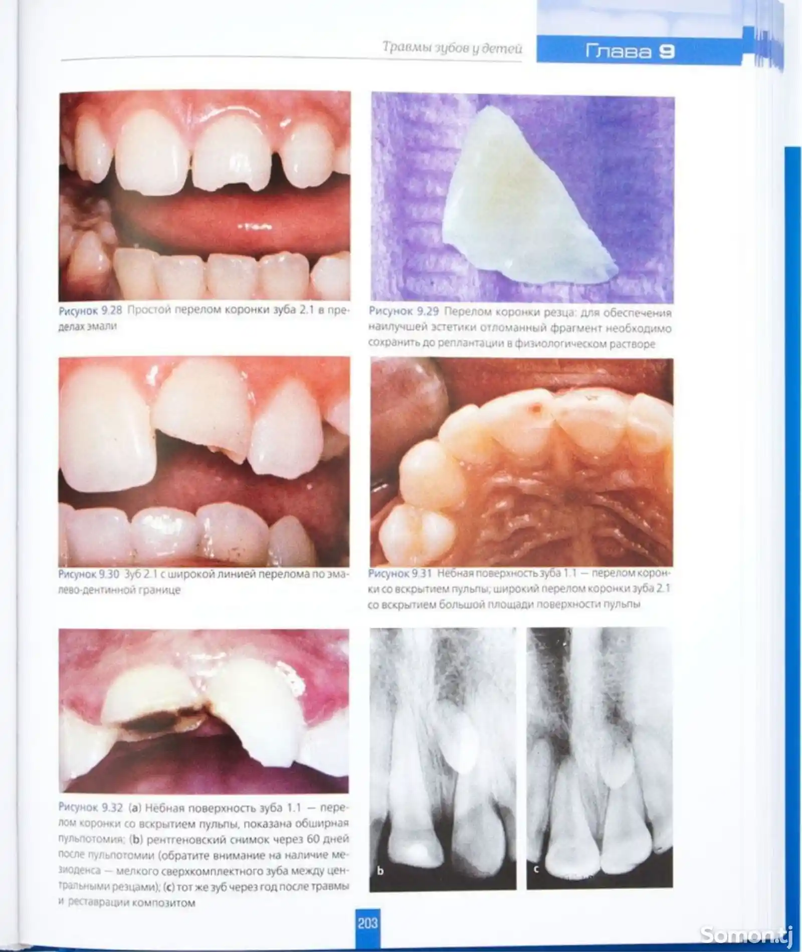 Книга Детская стоматология-7