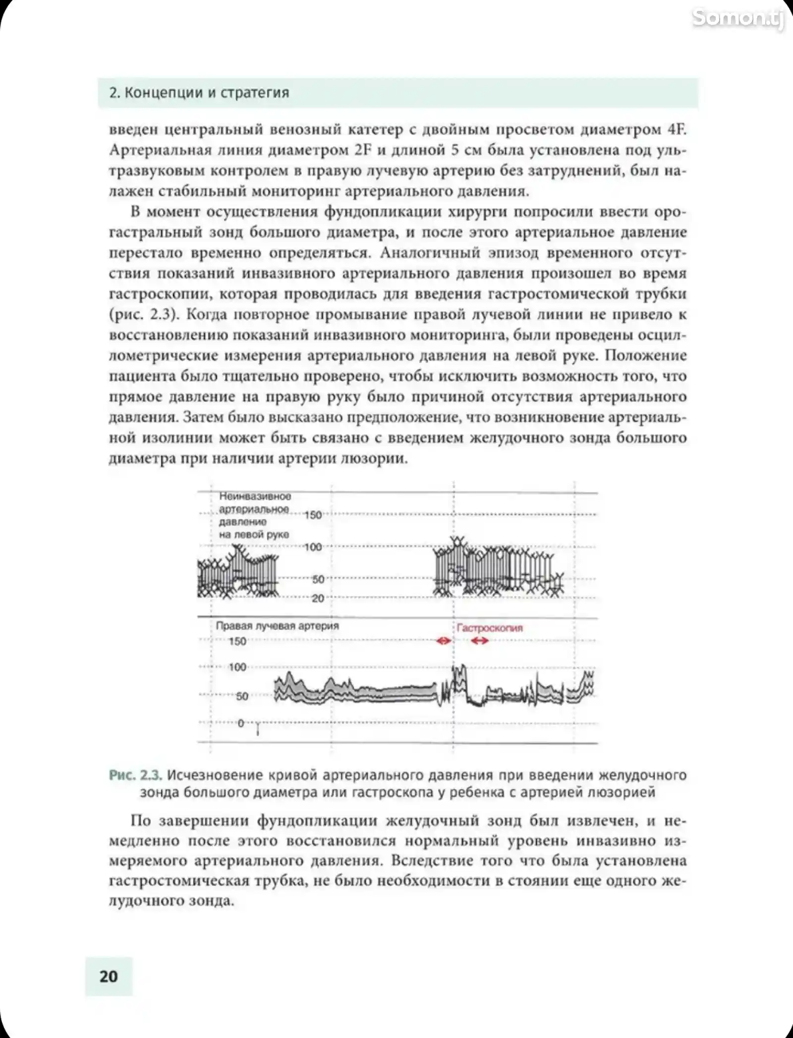 Книга Осложнения детской анестезиологии-10