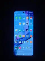 Xiaomi Redmi note 11-4