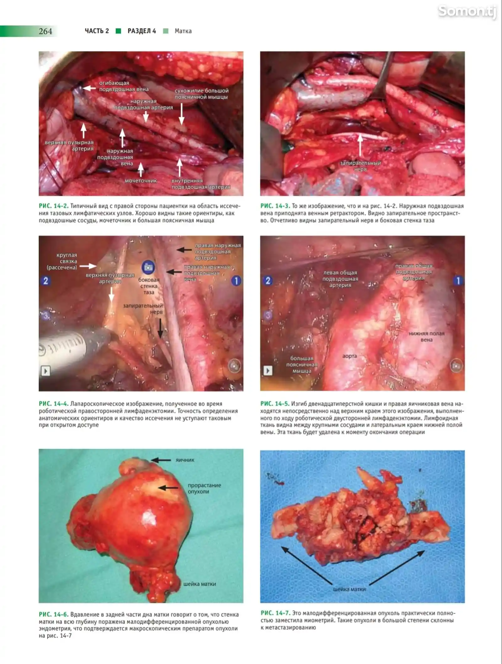 Атлас анатомии таза и гинекологической хирургии-14