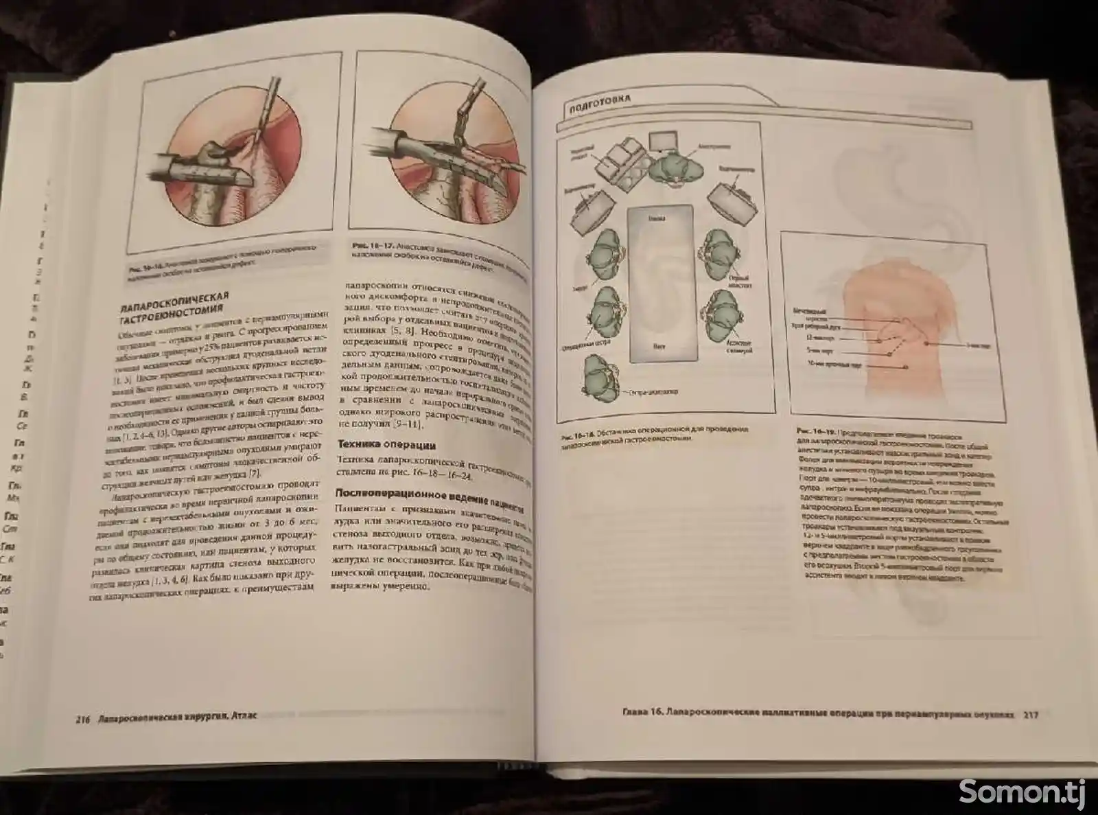 Книга лапароскопическая хирургия атлас-4