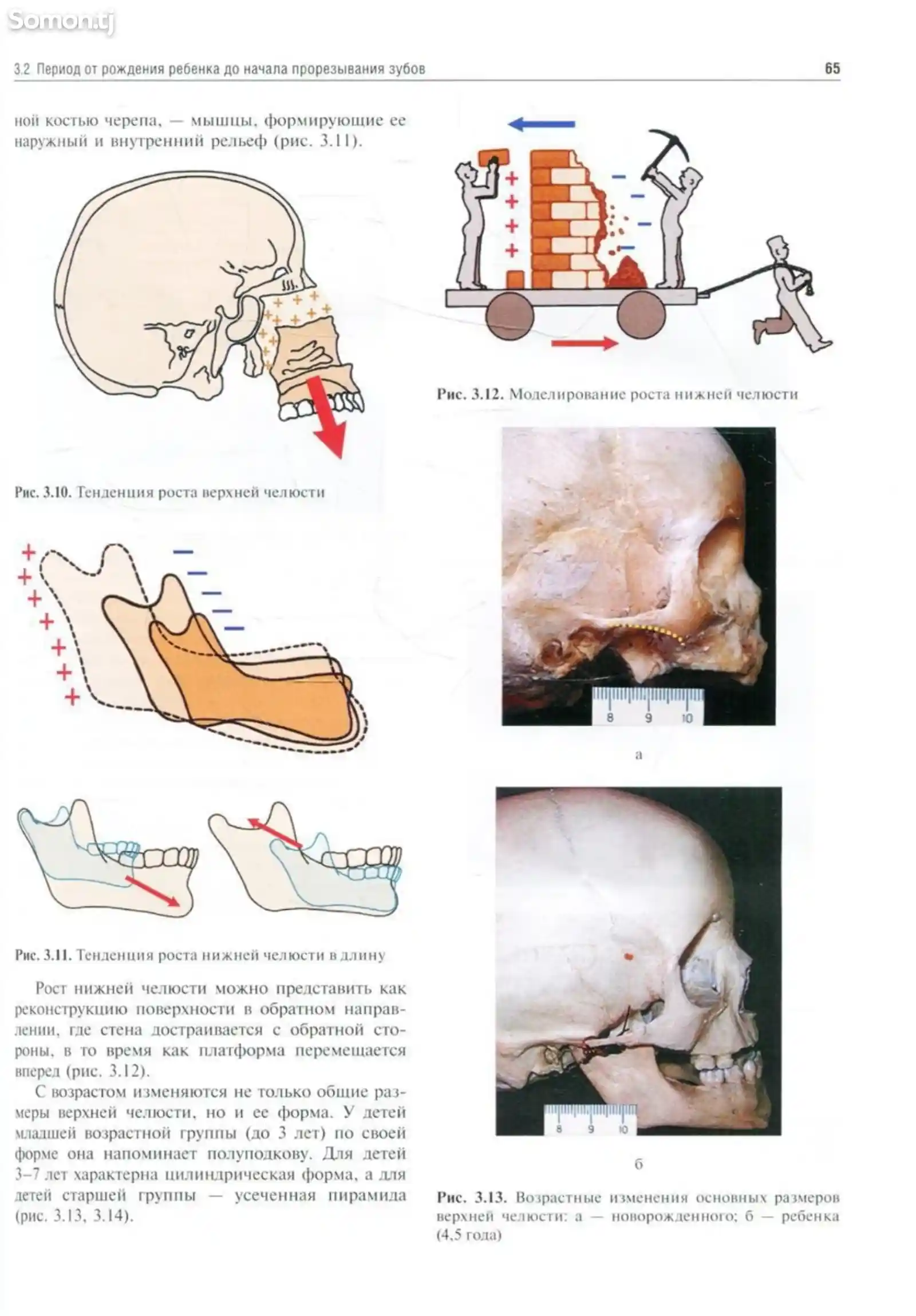 Учебник Ортодонтия на заказ-13