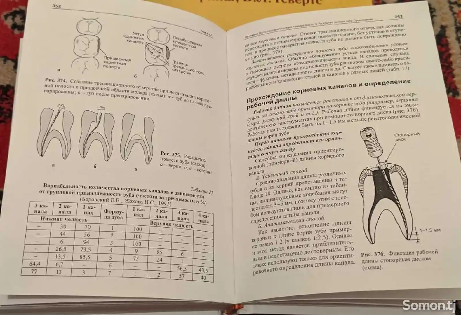 Книга Фантомный курс терапевтической стоматологии-9
