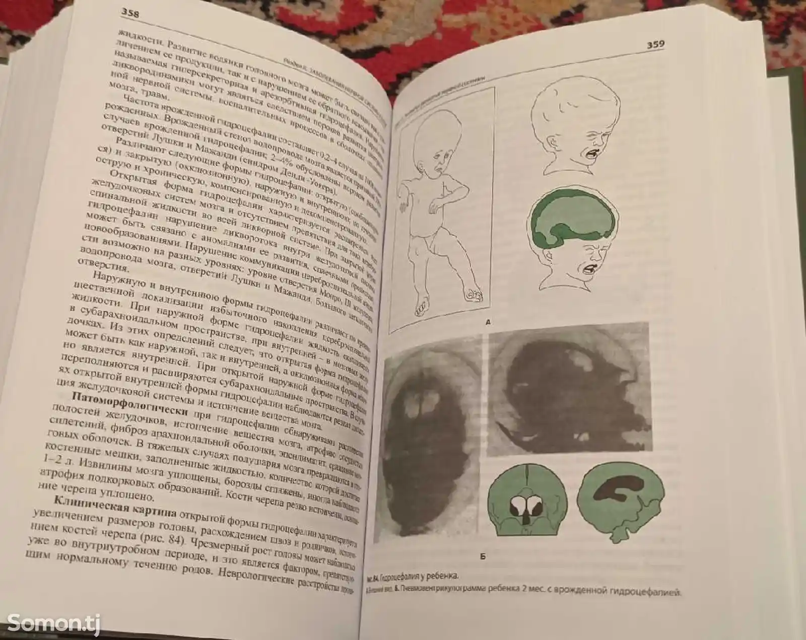 Книга Детская Неврология-7