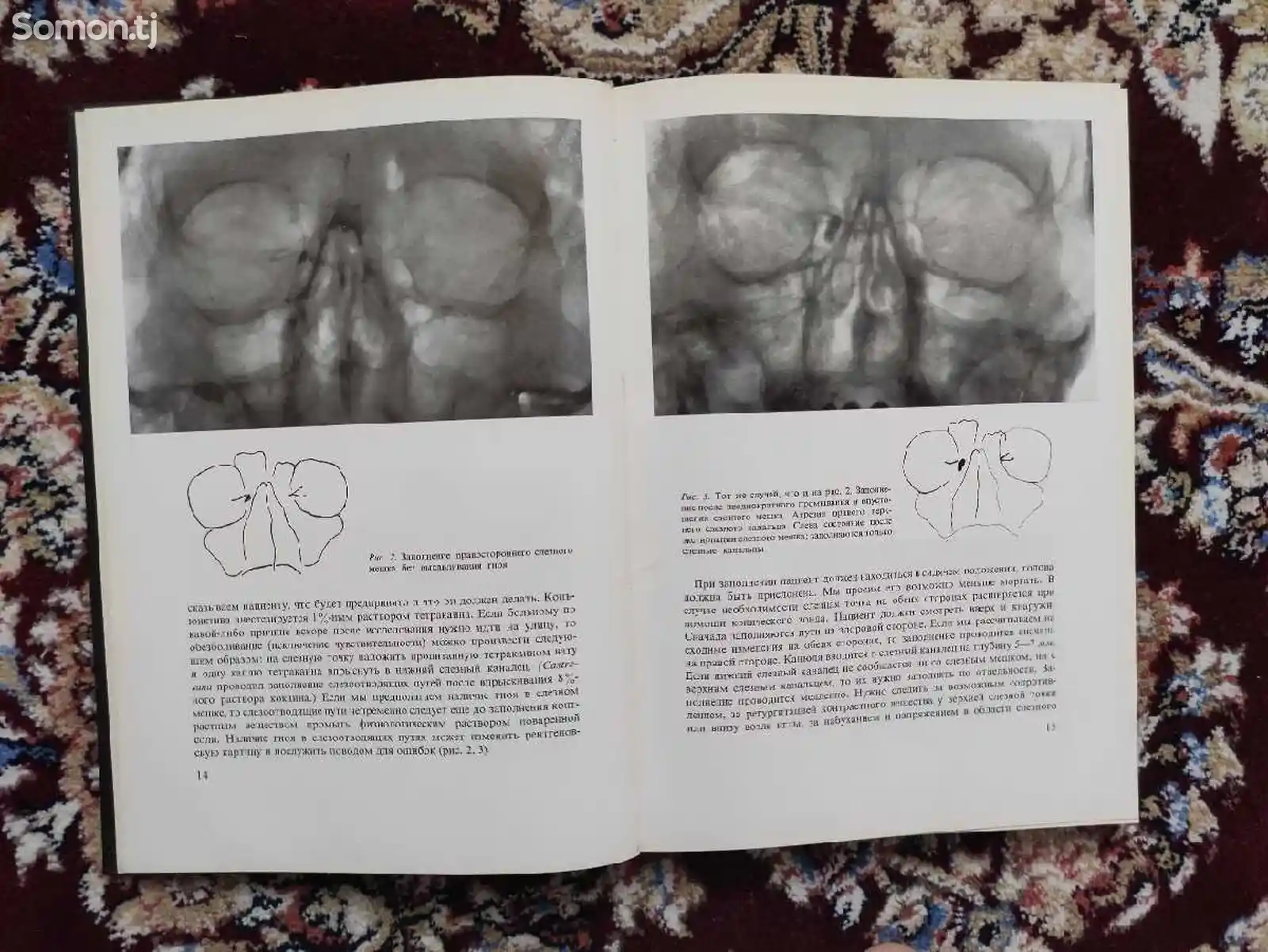 Книга рентгенодиагностика-5
