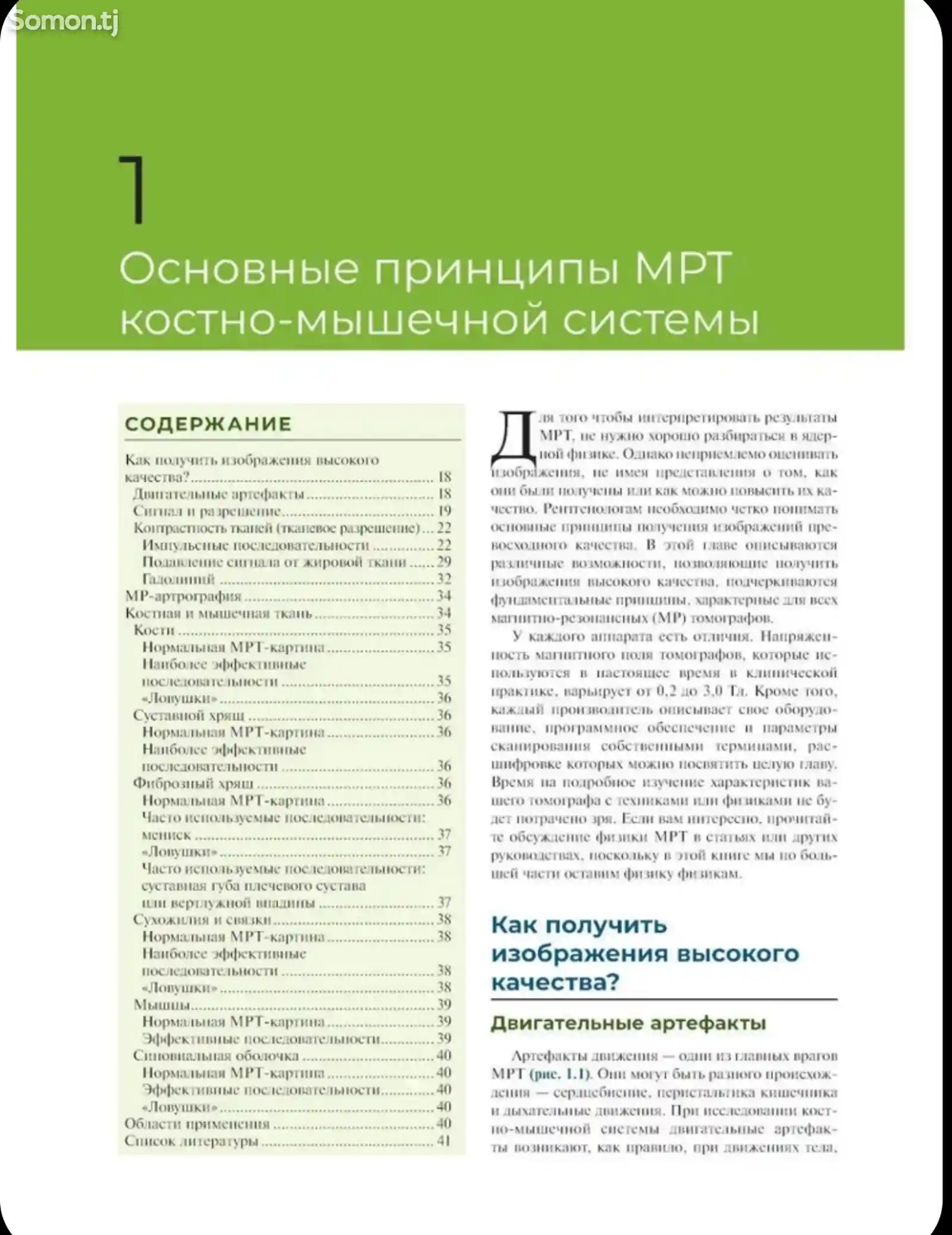 Книга МРТ костно мышечной системы-11