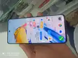 Huawei Honor X9b-7