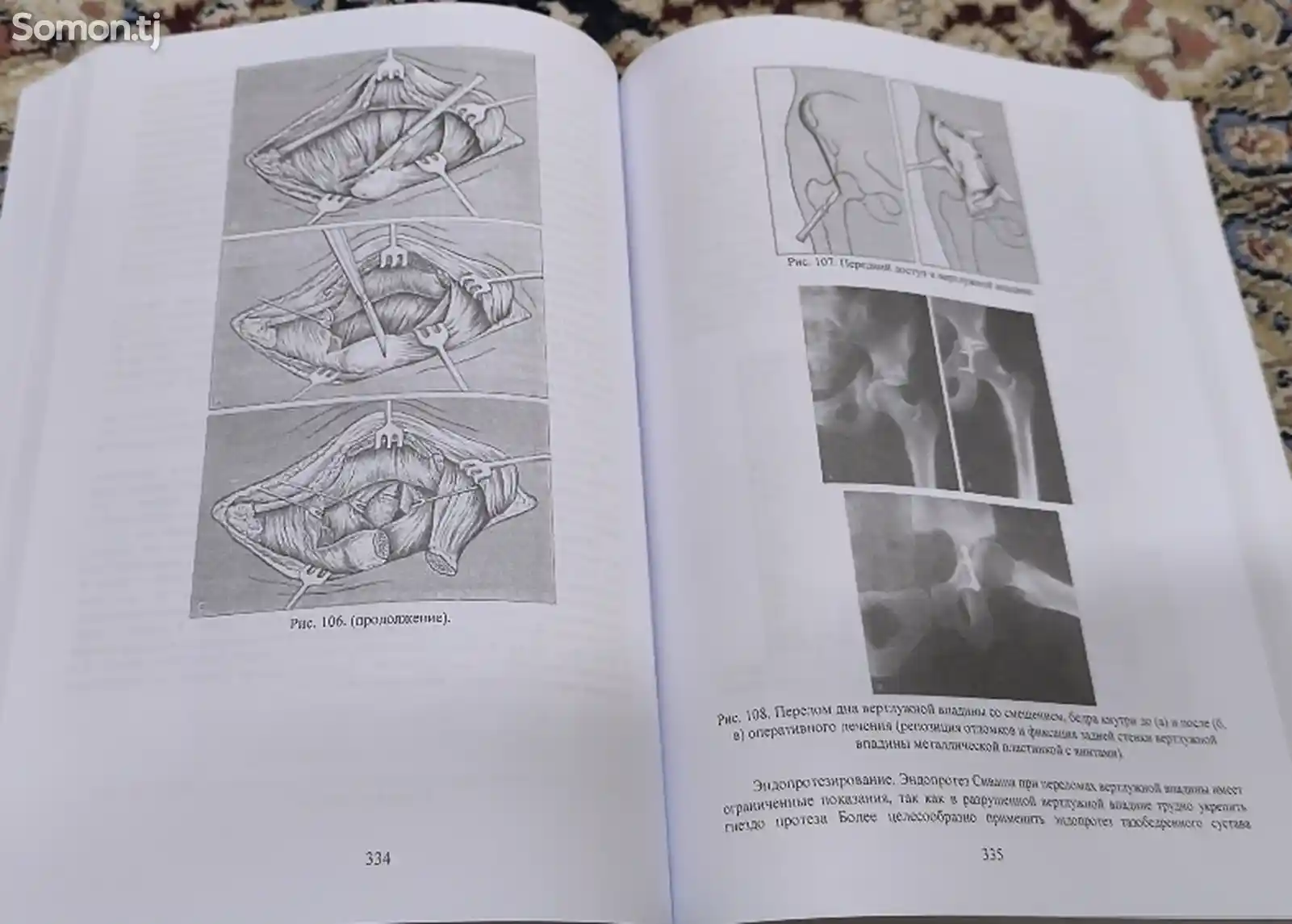 Книга повреждения костей и суставов-11