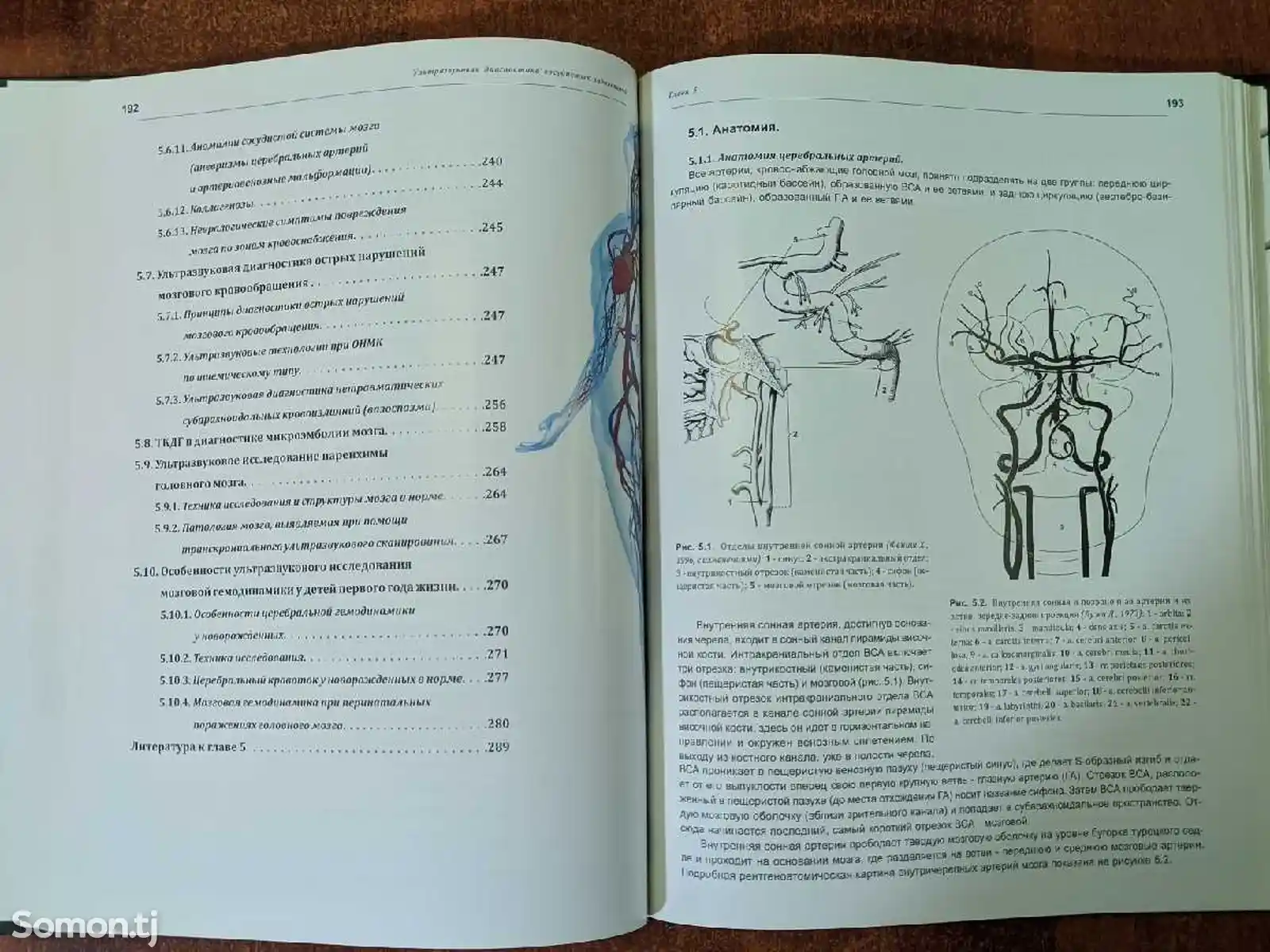 Книга Ультразвуковая диагностика сосудистых заболеваний-9