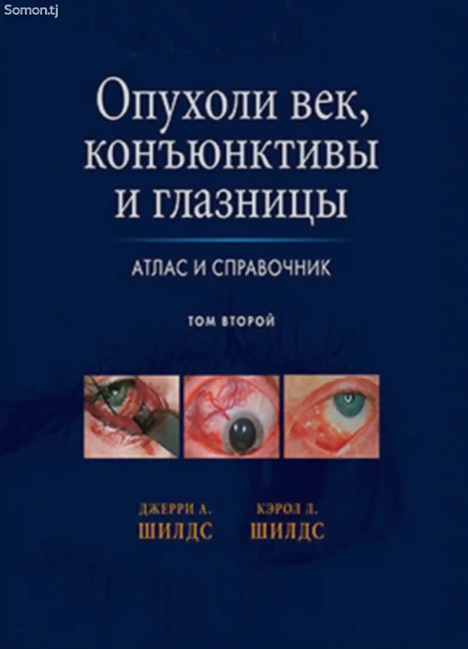 Атлас и справочник Опухоли век конъюнктивы и глазницы-1