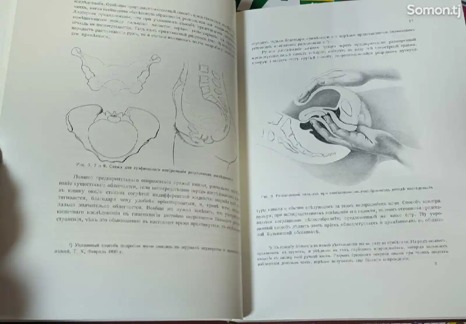 Книга Оперативная гинекология-8