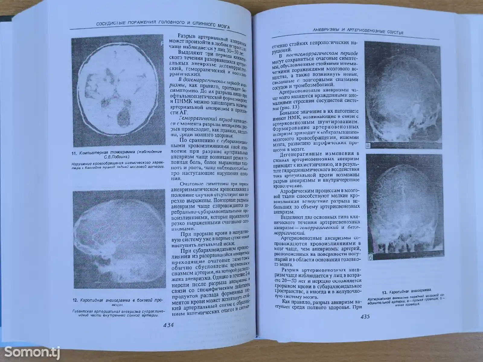 Книга Диагностика нервных болезней-7