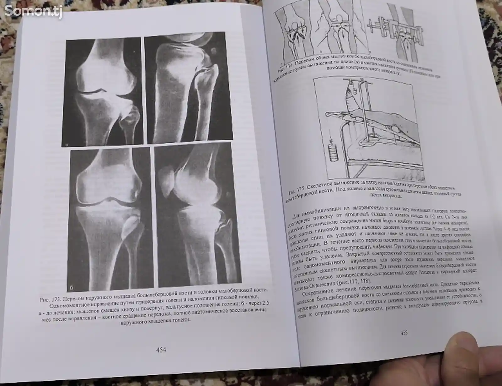 Книга повреждения костей и суставов-6